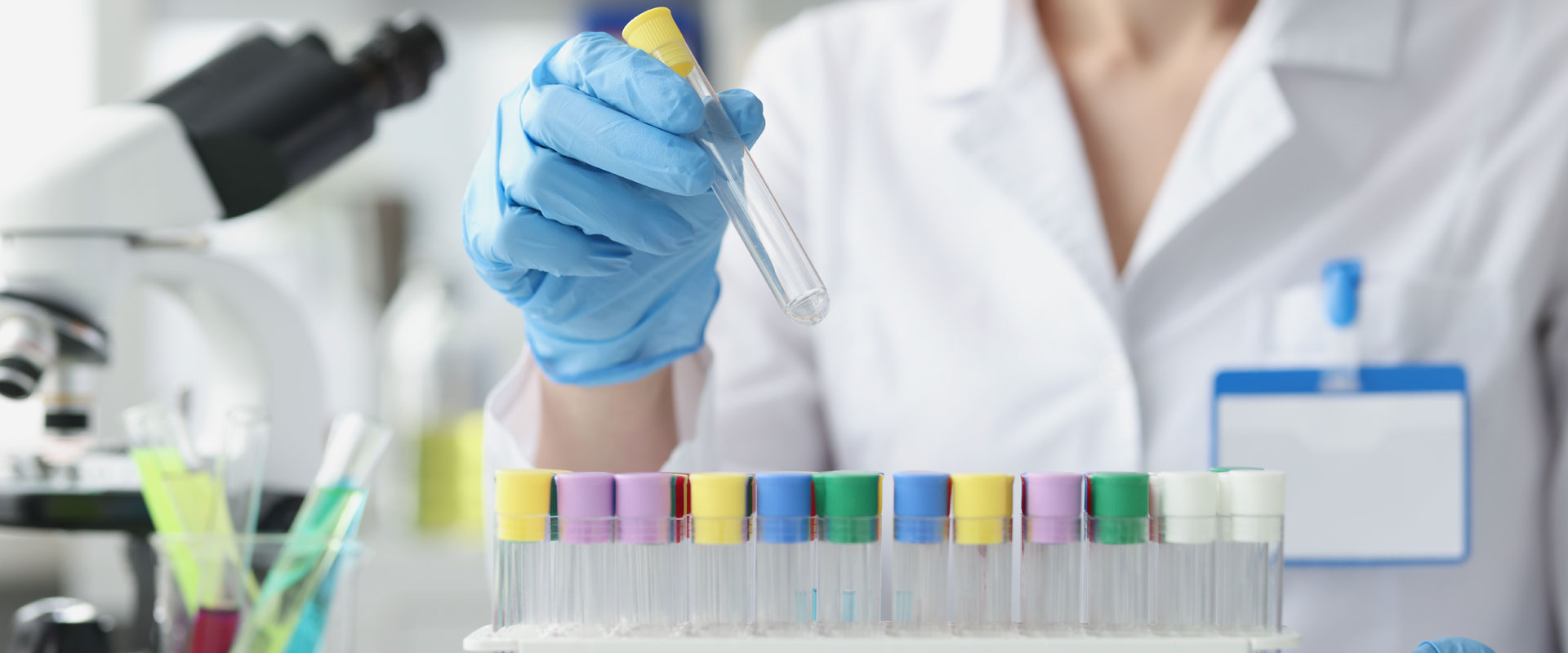 Profilo Metabolico: Cos’è, Valori, Esami e Preparazione