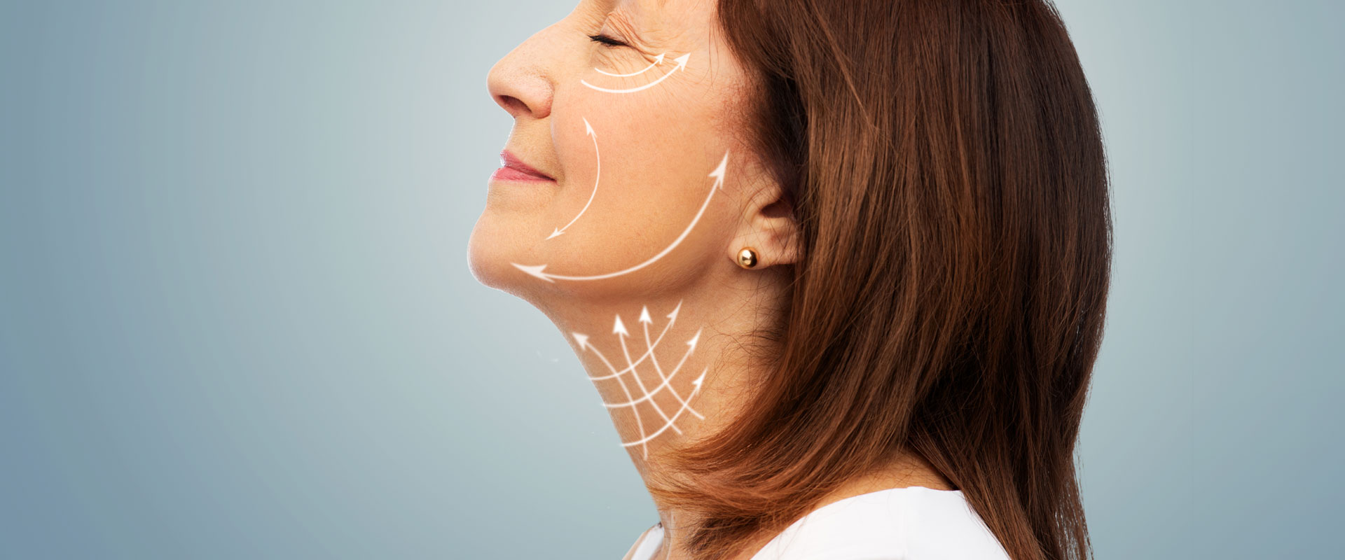 Fili estetici: sollevare il viso e rallentare il tempo
